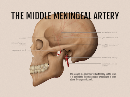Middle Meningeal artery